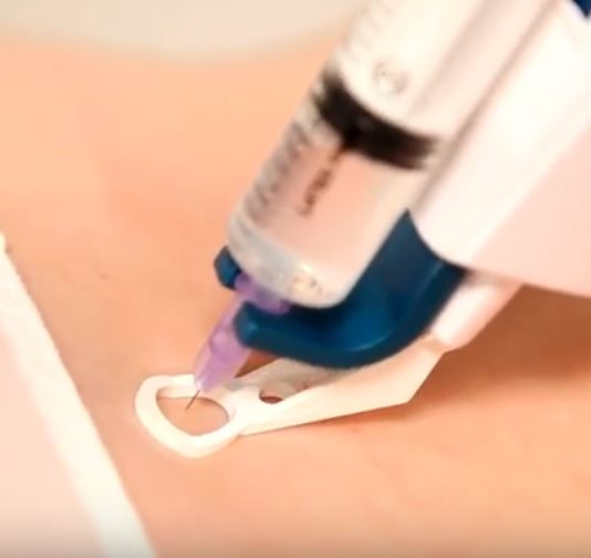 Treatment Image